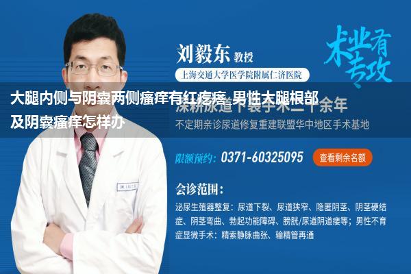 大腿内侧与阴囊两侧瘙痒有红疙瘩_男性大腿根部及阴囊瘙痒怎样办